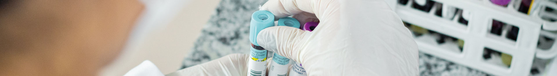 Laboratório de Análises Clínicas | Dr. João Carlos Grigoli - Unoeste